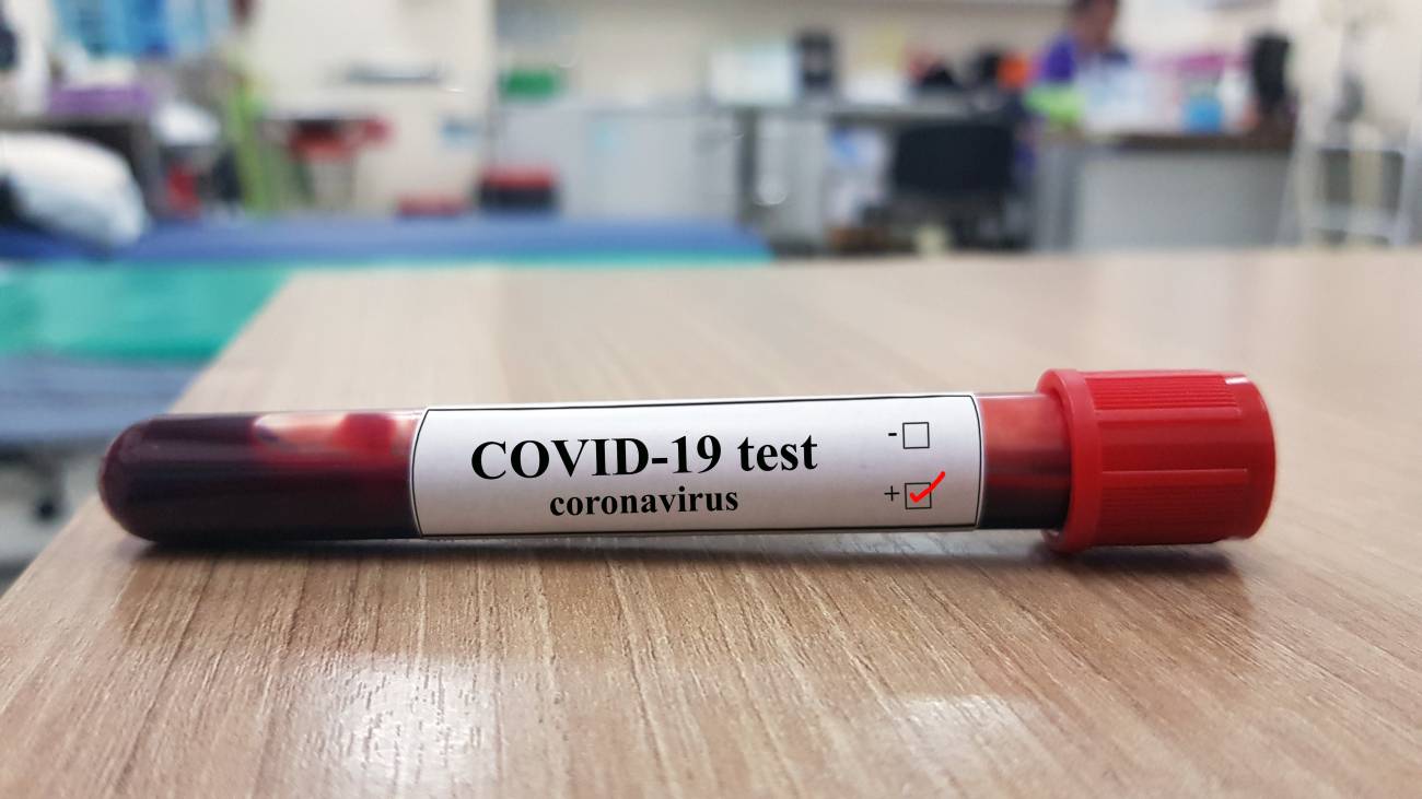 Cerraron laboratorio que alteraba pruebas covid en Cali