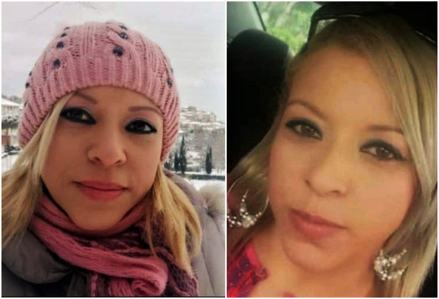 Mujer falleció después de someterse a un tratamiento estético en Cali.
