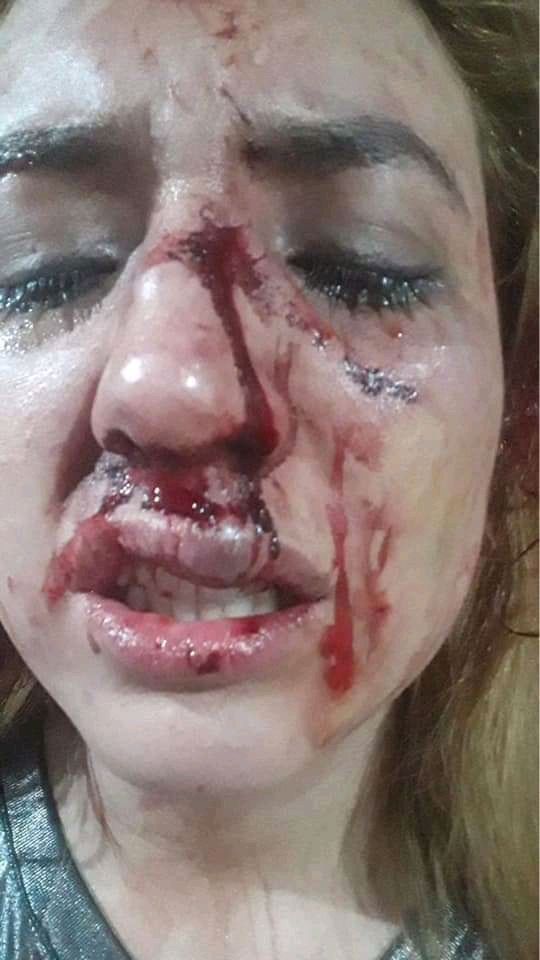 Mujer denunció brutales agresiones de su expareja en Popayán