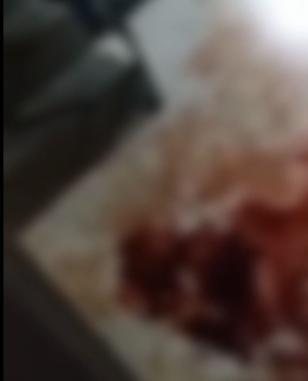 Violenta noche de agresión en Caloto Cauca, hombre agrede con cuchillo a su pareja sentimental