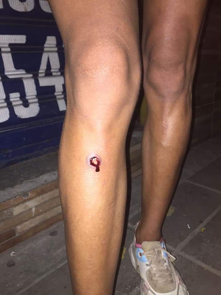 Le dispararon a mujer trans en el sector de La Esmeralda