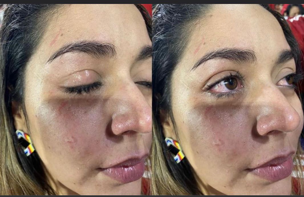 En el Estadio Pascual Guerrero una mujer fue golpeada