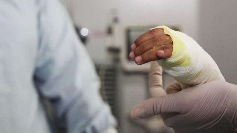Ocho personas resultaron afectadas por pólvora en la noche de velitas en el Departamento del Cauca