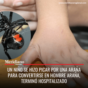 Meridiano regional - Un niño se hizo picar por una araña para convertirse en hombre araña – noticias niño picado por araña – niño quería ser hombre araña