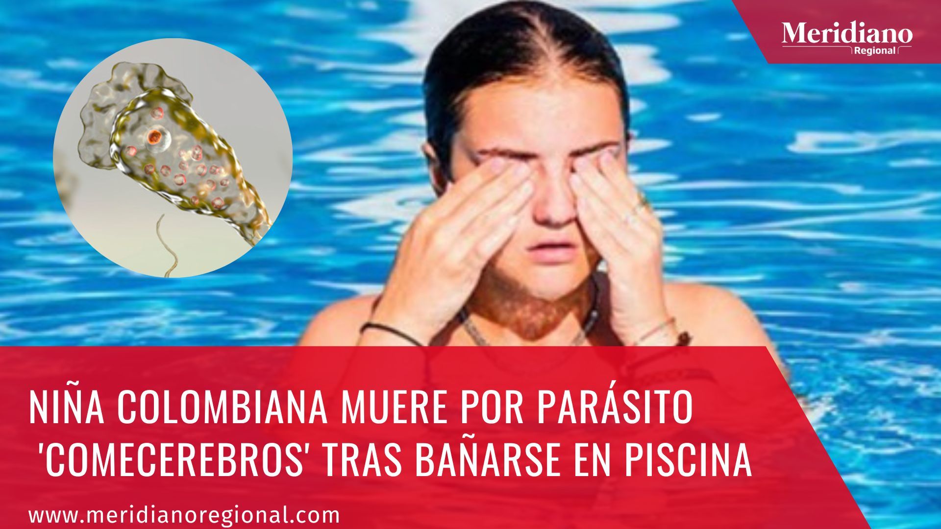 Meridiano regional - Niña colombiana muere por parásito 'comecerebros' tras bañarse en piscina – noticias cauca – noticias colombia