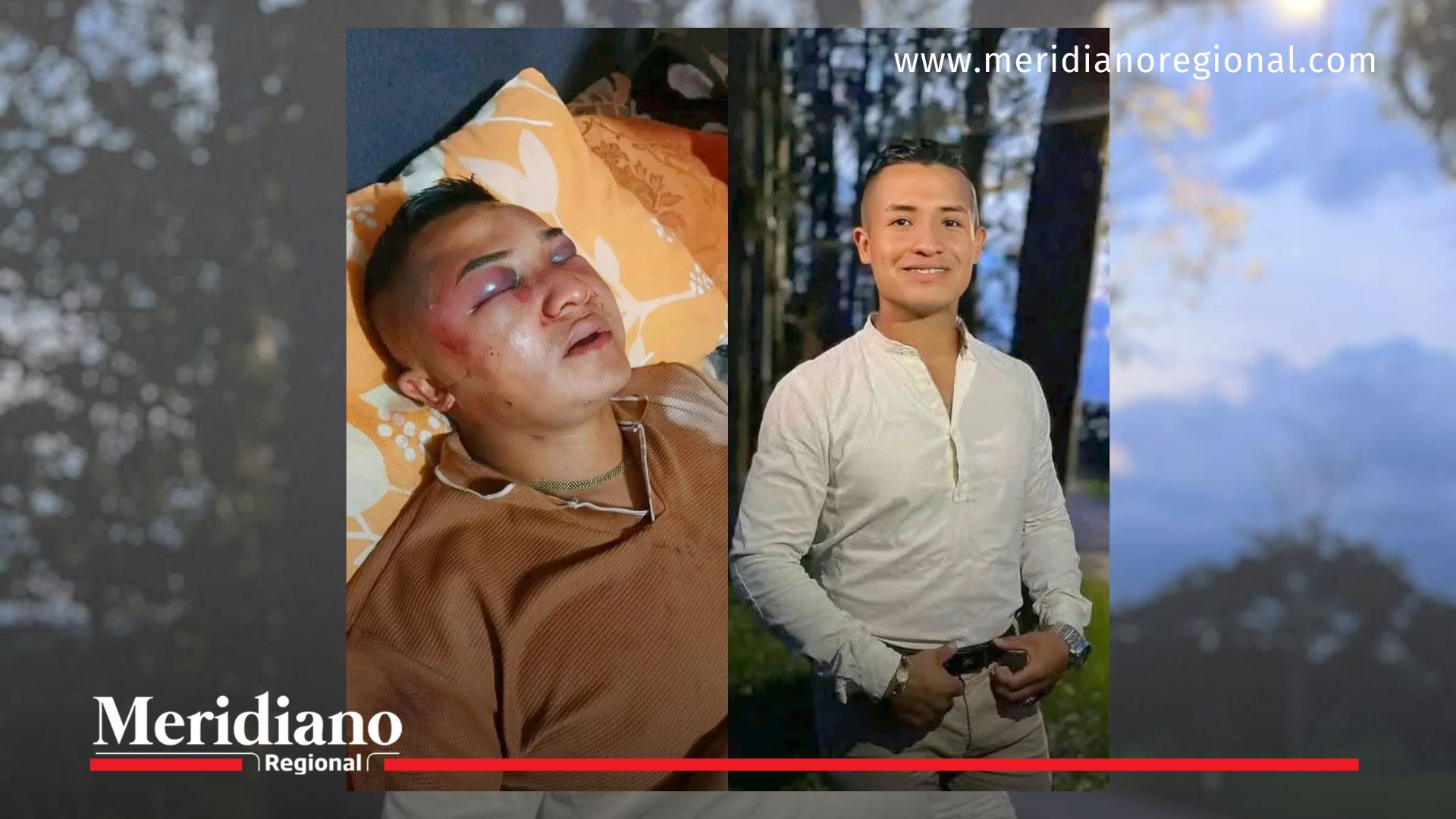 cantante-janio-sánchez-herido-en-atraco-en-cajibío-cauca
