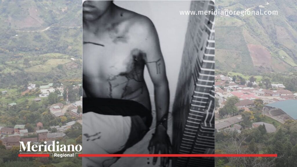 Menor herido en Jambaló durante la ofensiva simultánea en el Cauca, imagen en blanco y negro suministrada por autoridades indígenas.