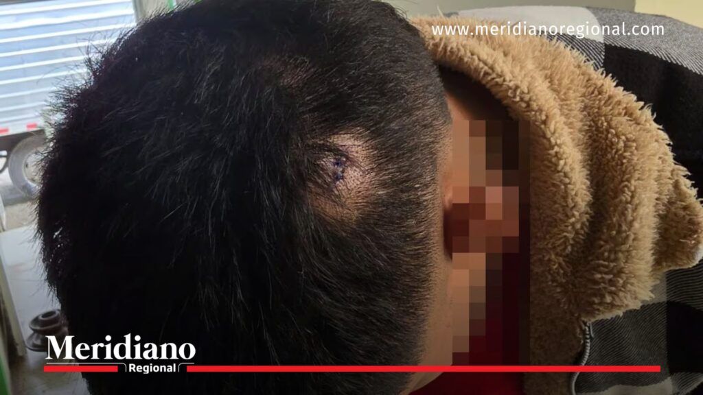 Herida atendida tras ataque en la inseguridad en la vía Panamericana - Meridiano Regional Víctima con herida atendida tras ataque en medio de la inseguridad en la vía Panamericana.