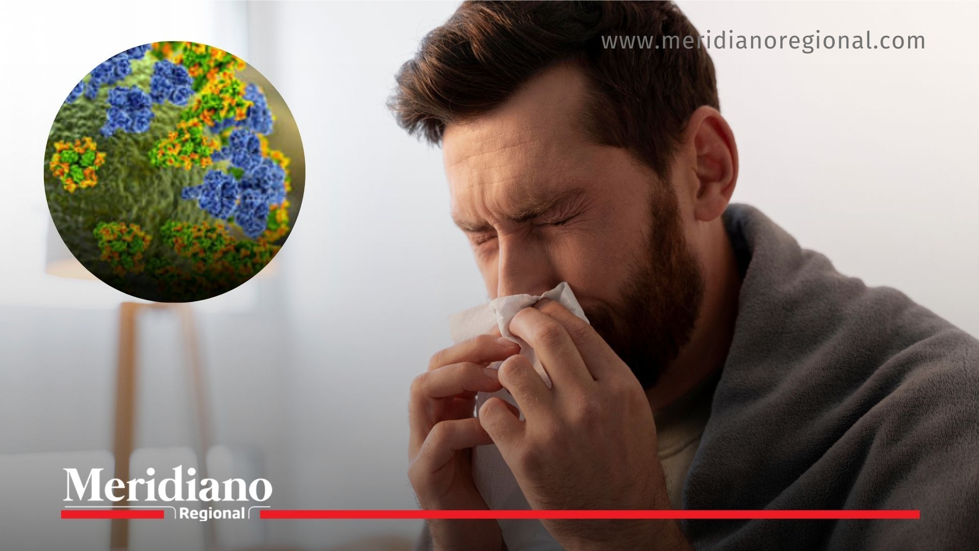 Imagen de referencia que ilustra los síntomas respiratorios asociados a la influenza A(H3N2), como fiebre, rinorrea y tos, confirmados en el primer caso detectado en Colombia.