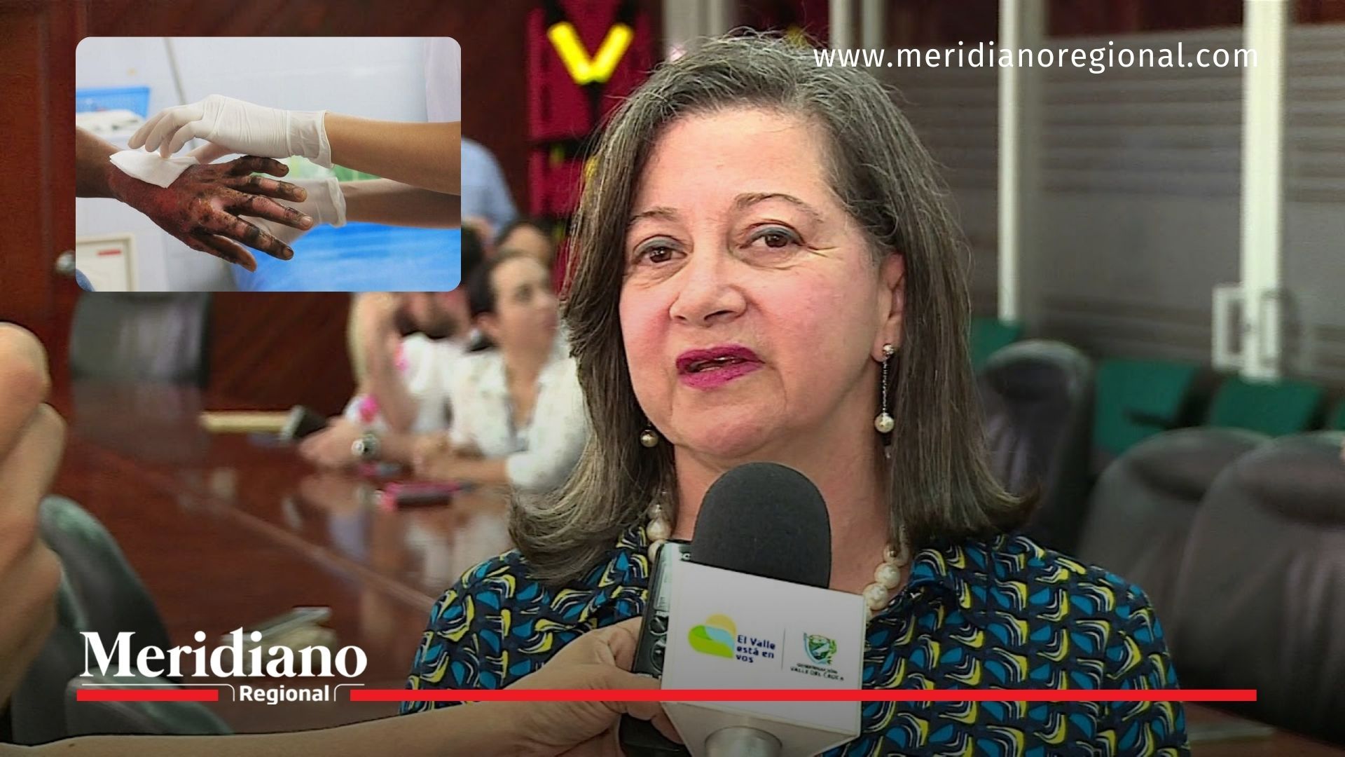Secretaria de Salud del Valle del Cauca habla sobre quemados por pólvora en el departamento