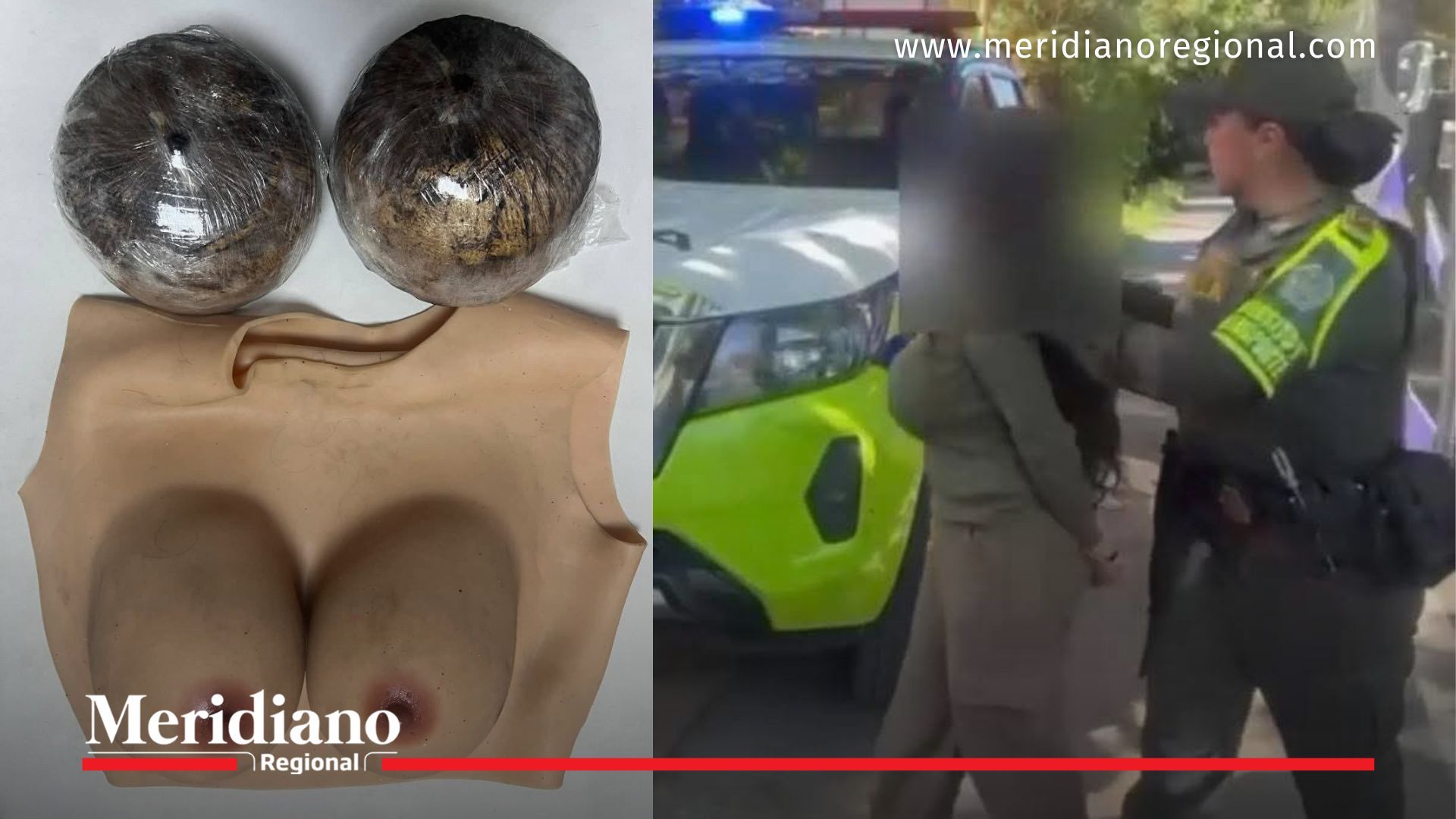 droga en prótesis mujer capturada en Valle del Cauca con droga oculta en prótesis mamarias
